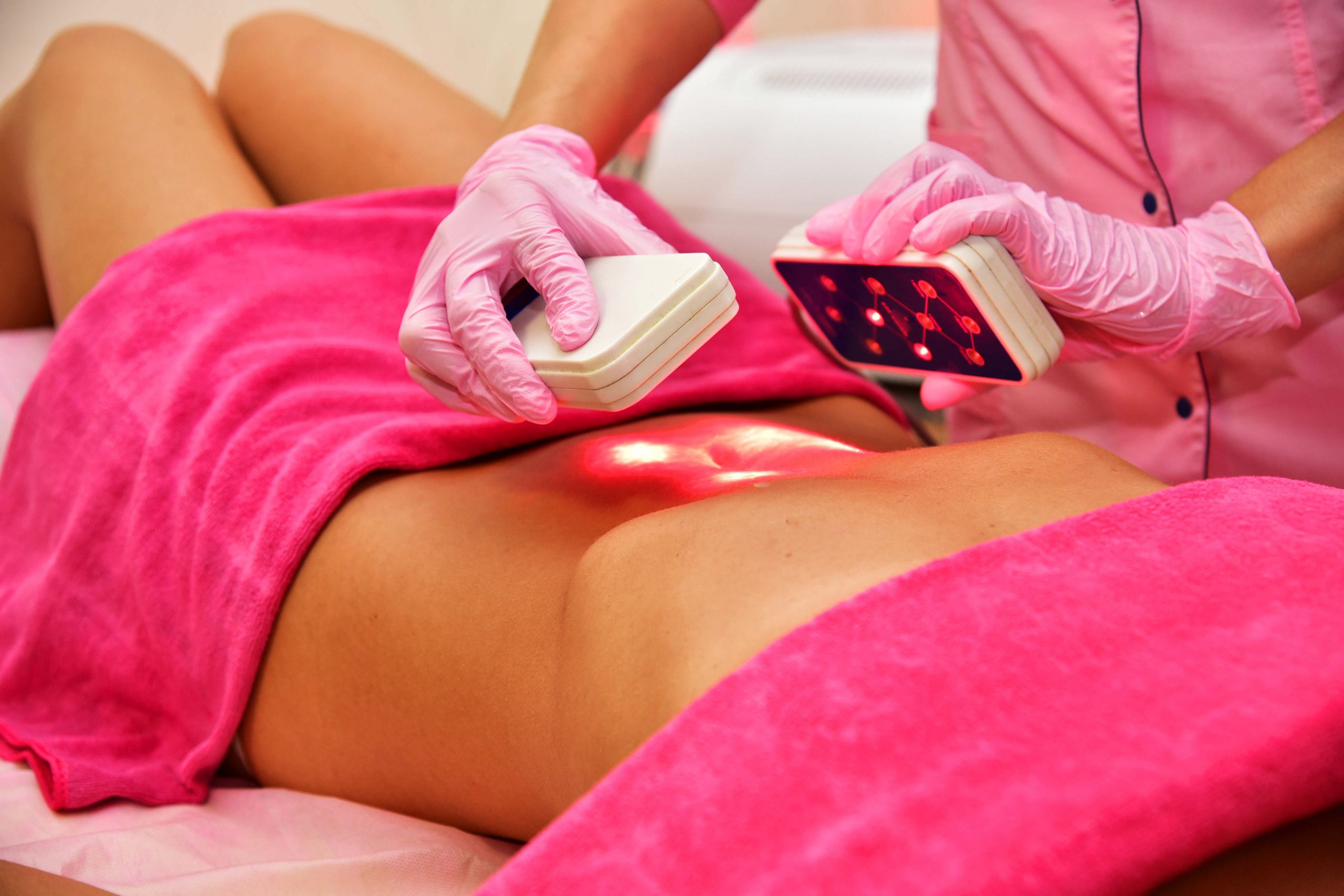 Laser Lipo